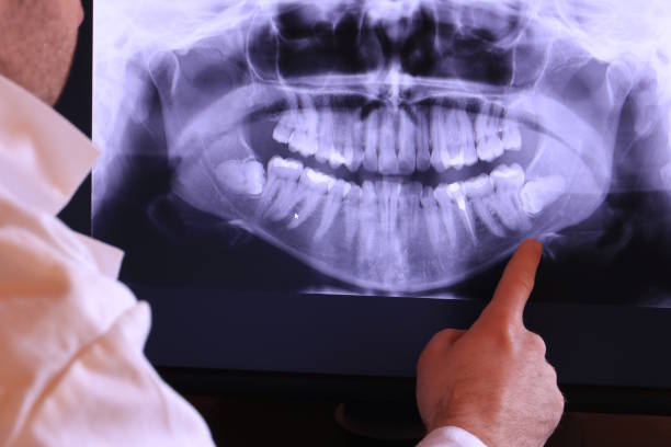 Best Emergency Care for Gum Disease in Hoer, OK