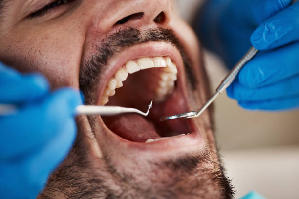 Best Emergency Denture Repair in Hoer, OK