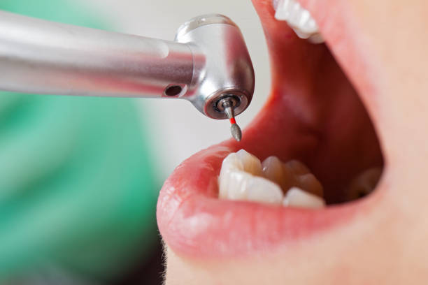 Best Emergency Cosmetic Dentistry (e.g., broken veneers) in Hoer, OK